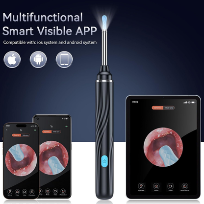Wireless Smart Ear Cleaner with HD Camera | iPhone & Android Compatible