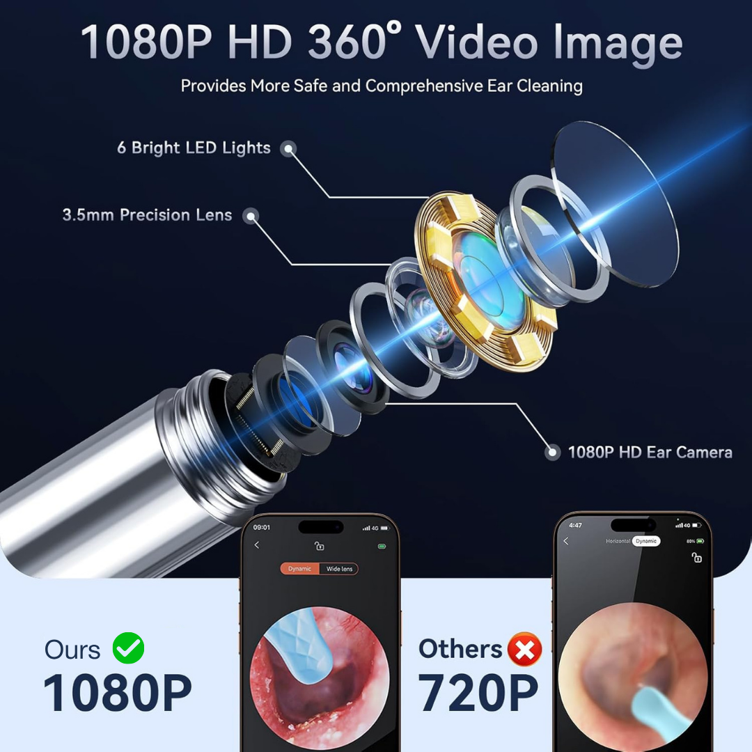 Wireless Smart Ear Cleaner with HD Camera | iPhone & Android Compatible